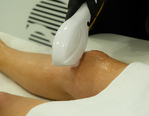 Lazer Epilasyon ve IPL Tedavileri